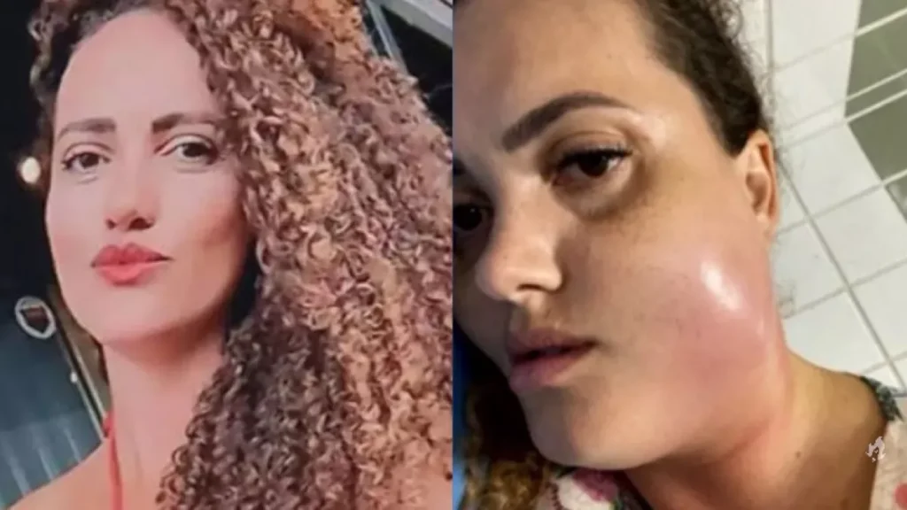 Mulher vai ao dentista e acaba perdendo a vida, por conta de um procedimento que todos fazemos